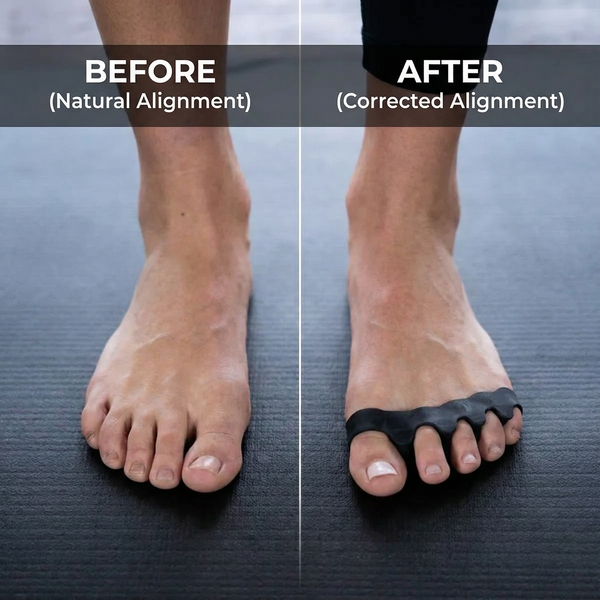 Vibit ALIGN - Toe Spacers